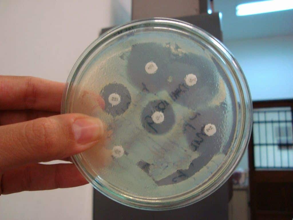 Antibiograma, la solución definitiva para las infecciones de orina 2